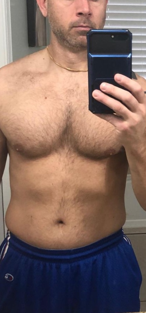 Enzo antes